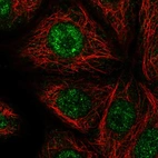 Immunofluorescent staining of human cell line MCF7 shows localization to nucleoplasm.