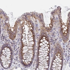 Immunohistochemical staining of human colon shows strong positivity in Golgi apparatus in glandular cells.