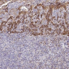 Immunohistochemical staining of human tonsil shows moderate cytoplasmic positivity in squamous epithelial cells.