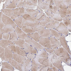 Immunohistochemical staining of human skeletal muscle shows moderate cytoplasmic positivity in myocytes.