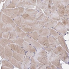 Immunohistochemical staining of human skeletal muscle shows moderate cytoplasmic positivity in myocytes.