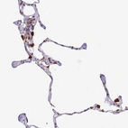 Anti-TMEM104 Antibody