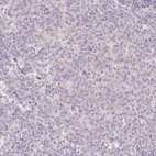 Immunohistochemical staining of human tonsil shows no membranous positivity in germinal center cells as expected.