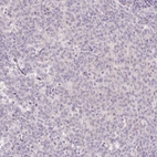Immunohistochemical staining of human tonsil shows no membranous positivity in germinal center cells as expected.