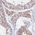 Immunohistochemical staining of human testis shows moderate cytoplasmic positivity in Leydig cells.