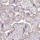 Immunohistochemical staining of human placenta shows very weak membranous positivity in trophoblastic cells.