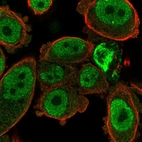 Immunofluorescent staining of human cell line PC-3 shows localization to nucleoplasm.