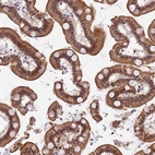 Immunohistochemical staining of human small intestine shows strong membranous and cytoplasmic positivity in glandular cells.