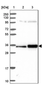 Lane 1: Marker [kDa] 250, 130, 95, 72, 55, 36, 28, 17, 10_br/_Lane 2: Human cell line RT-4_br/_Lane 3: Human cell line U-251MG sp