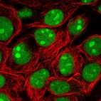 Immunofluorescent staining of human cell line MCF7 shows localization to nucleus & nucleoli.