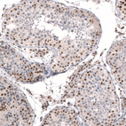 Immunohistochemical staining of human testis shows moderate to strong nuclear positivity in cells in seminiferous ducts.