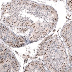Immunohistochemical staining of human testis shows moderate to strong nuclear positivity in cells in seminiferous ducts.