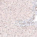 Immunohistochemical staining of human liver shows very weak nuclear positivity in hepatocytes.