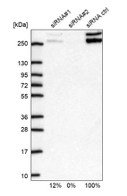 Western blot analysis in U2OS cells transfected with control siRNA, target specific siRNA probe #1 and #2, using Anti-CIC antibody. Remaining relative intensity is presented