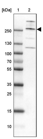 Lane 1: Marker [kDa] 250, 130, 100, 70, 55, 35, 25, 15, 10_br/_Lane 2: Human cell line A-549