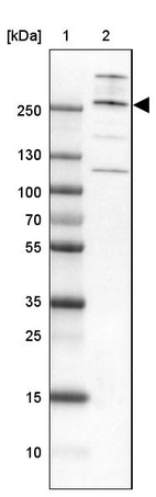 Lane 1: Marker [kDa] 250, 130, 100, 70, 55, 35, 25, 15, 10_br/_Lane 2: Human cell line A-549