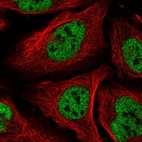 Immunofluorescent staining of human cell line U-2 OS shows localization to nucleoplasm.