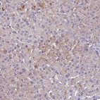 Anti-SLC13A5 Antibody