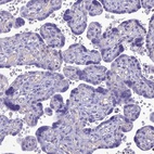 Immunohistochemical staining of human placenta shows no positivity in trophoblastic cells as expected.