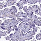 Immunohistochemical staining of human placenta shows no positivity in trophoblastic cells as expected.