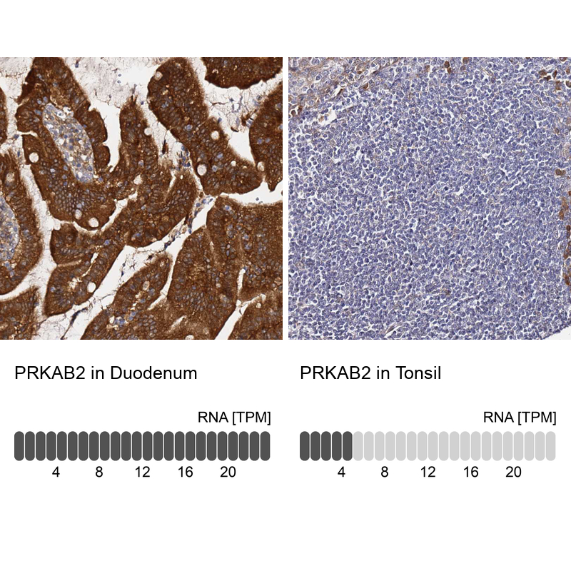 Anti-PRKAB2 Antibody