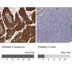 Anti-PRKAB2 Antibody