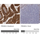 Anti-PRKAB2 Antibody