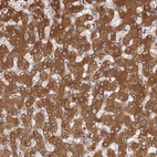 Immunohistochemical staining of human liver shows strong cytoplasmic positivity in hepatocytes.