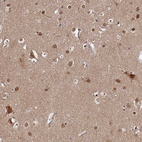 Immunohistochemical staining of human cerebral cortex shows moderate cytoplasmic positivity in neurons.