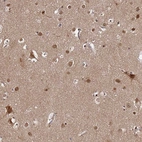 Immunohistochemical staining of human cerebral cortex shows moderate cytoplasmic positivity in neurons.