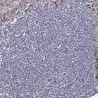 Immunohistochemical staining of human tonsil shows no positivity in non-germinal center cells as expected.