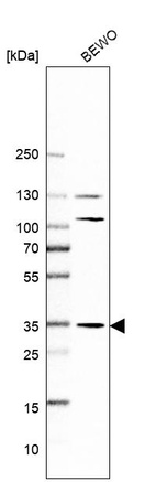Western blot analysis in human cell line BEWO.