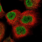 Immunofluorescent staining of human cell line A-431 shows localization to nucleoplasm.