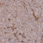 Anti-ARRDC1 Antibody