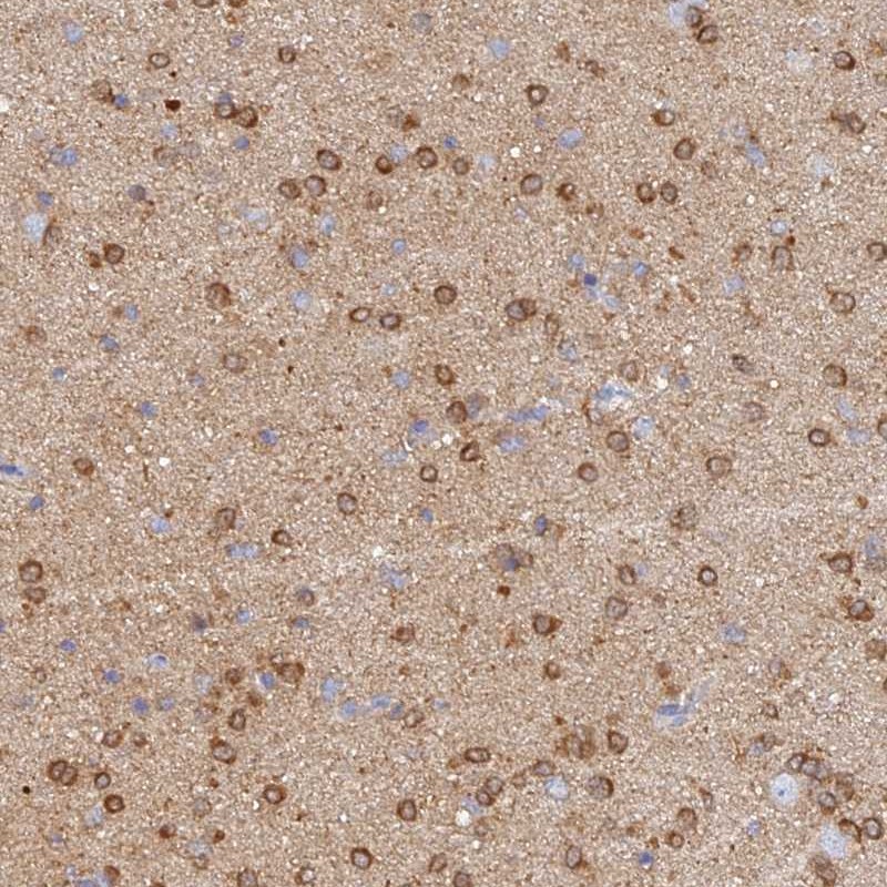 Anti-CACNA1B Antibody