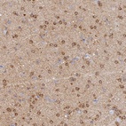 Anti-CACNA1B Antibody