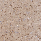 Anti-CACNA1B Antibody