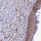 Immunohistochemical staining of human skin shows moderate cytoplasmic/membranous positivity in endothelial cells and squamous epithelial cells.