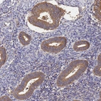 Immunohistochemical staining of human endometrium shows moderate cytoplasmic/membranous positivity in glandular cells.
