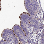 Anti-TEKT3 Antibody