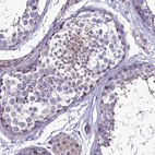 Immunohistochemical staining of human testis shows weak positivity in sperm flagellum..