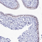 Immunohistochemical staining of human fallopian tube shows weak to moderate nuclear positivity in glandular cells.