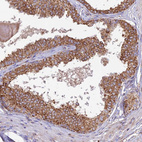 Anti-UAP1L1 Antibody