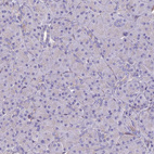 Immunohistochemical staining of human pancreas shows no positivity in exocrine glandular cells as expected.