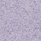 Immunohistochemical staining of human pancreas shows no positivity in exocrine glandular cells as expected.
