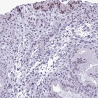 Immunohistochemical staining of human endometrium shows weak to moderate nuclear positivity in a subset of glandular cells.