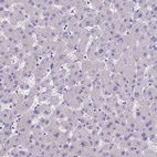 Immunohistochemical staining of human liver shows no positivity in hepatocytes as expected.