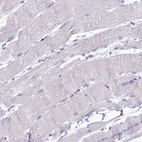 Immunohistochemical staining of human skeletal muscle shows no positivity in myocytes as expected.