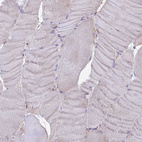 Immunohistochemical staining of human skeletal muscle shows no positivity in myocytes as expected.