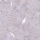 Immunohistochemical staining of human skeletal muscle shows no positivity in myocytes as expected.